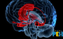 Quel est l'effet d'un stress intense sur le cerveau de l'enfant ?